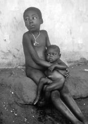 250 section d:2 37 Two malnourished Nigerian children during the Nigerian-Biafran civil war, 1968: Not enough has changed in many parts of the world in the last 3 decades (CDC/Dr.
