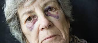 ELDER ABUSE- Physical Description Force against the elderly resulting in bodily injury, physical pain or impairment.