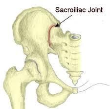 Common Conditions and Injuries of the Hip Sacroiliac (SI) Joint Dysfunction Ø Occurs when there is either too much or too little motion at the SI joint, or when trauma knocks it out of alignment.