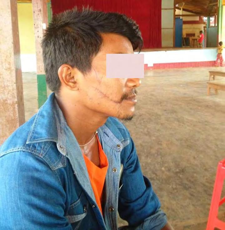 Case Studies 1) Kachin villager arbitrarily arrested and tortured by Burma army soldiers On 14 May around 22:00, Burma army soldiers came to the home of a 51 year old male assistant pastor in Mohnyin