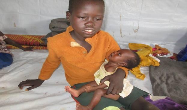 malaria and malnourishment.