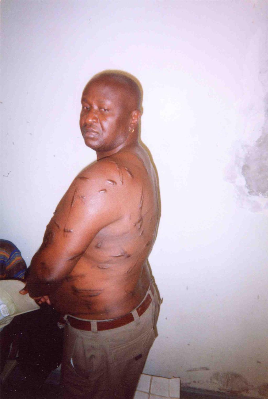 Namibia: Justice delayed is justice denied The Caprivi treason trial 13 Oscar Luphalezwi, a former senior policeman with more than 24 years experience, was one of those arrested and tortured
