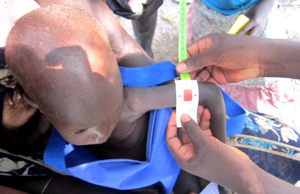 Jonglei State, Cholera response in Upper Nile State and Eastern Equatoria,