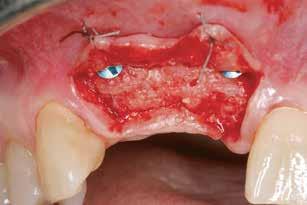 (Oral surgeon