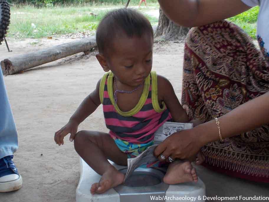 Handicapped and malnourished boy, Phum Thmey, June 2014.
