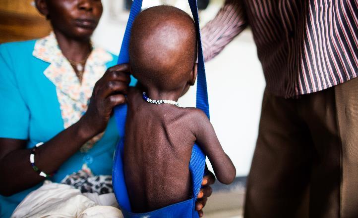 A child is weighed at Al Sabbah Hospital in Juba UNICEF/2016/South Sudan/ Albert Gonzalez Farran South Sudan SITUATION REPORT 11 FEBRUARY 2016 South Sudan Humanitarian Situation Report 29 JANUARY 11
