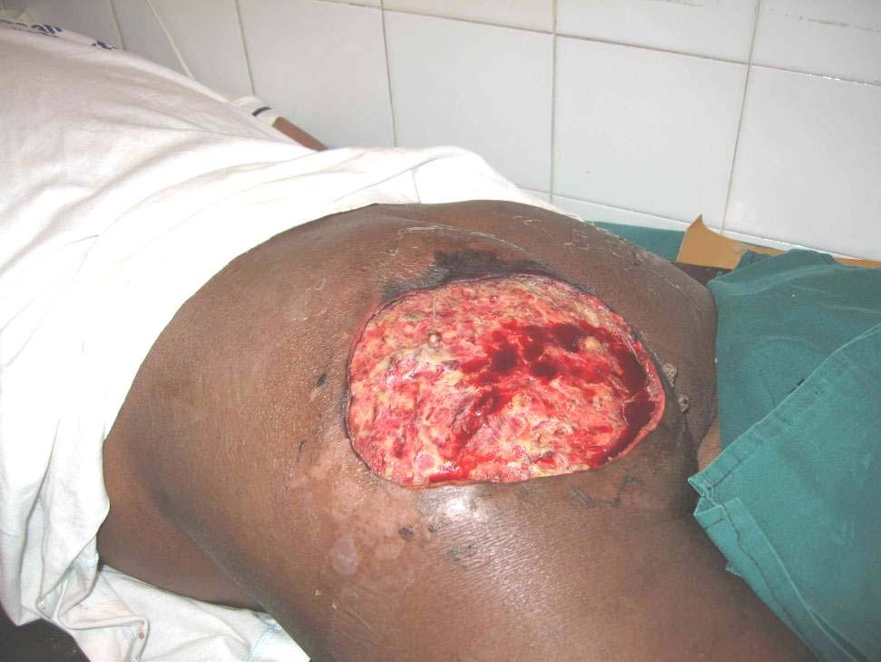 Photo 7: buttocks of man severely beaten by youth militia in