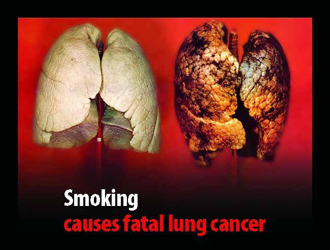 HOW DOES TOBACCO EXPOSURE THROUGH SMOKING CAUSE CANCER? Many of the poisons found in tobacco can damage your DNA and lead to cancer.